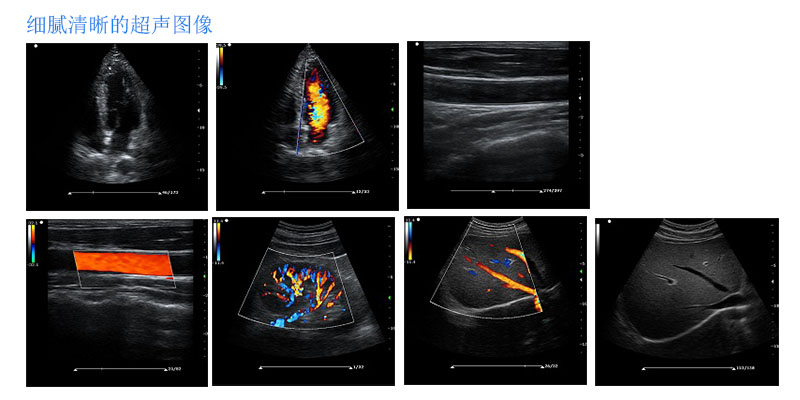 Superb ultrasound images by ES211V digital veterinary color Doppler ultrasound machine